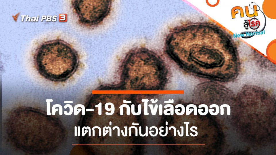 โควิด-19 กับไข้เลือดออก แตกต่างกันอย่างไร