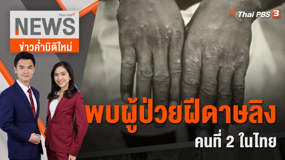 กรมควบคุมโรคยืนยันพบผู้ป่วยฝีดาษลิงคนที่ 2 ในไทย | ข่าวค่ำมิติใหม่ | 28 ก.ค. 65