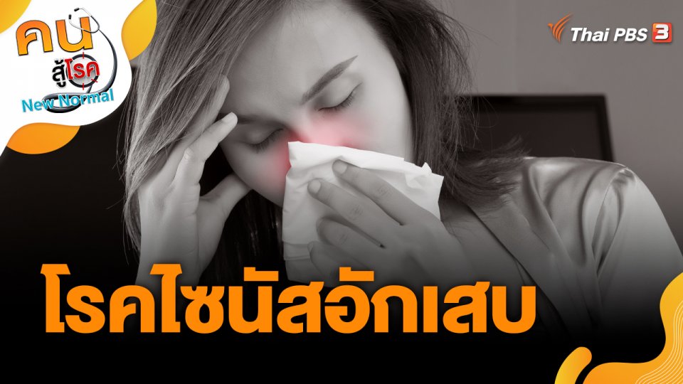 โรคไซนัสอักเสบ