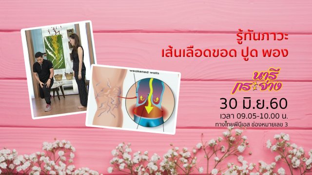 รู้ทันภาวะ "เส้นเลือดขอด-ปูด-พอง"