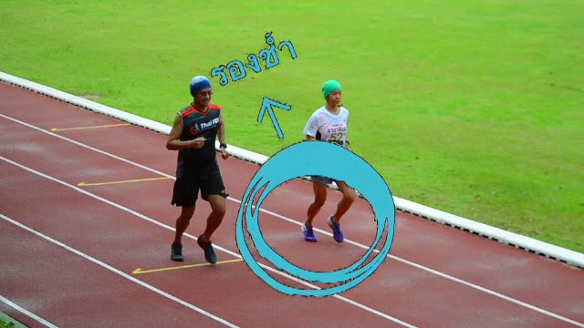 รองช้ำ โรคของคนยืนนาน วิ่งมาก