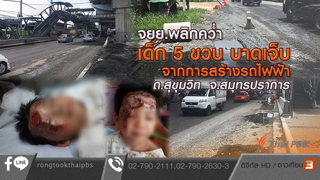 จยย.พลิกคว่ำ เด็ก 5 ขวบบาดเจ็บจากการสร้างรถไฟฟ้า จ.สมุทรปราการ