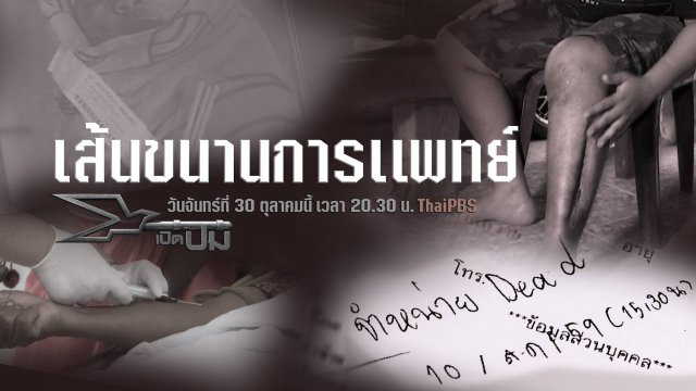 เส้นขนานการแพทย์