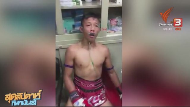 ประเด็นข่าว (3 ธ.ค. 60)