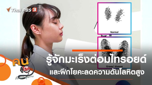 รู้จักมะเร็งต่อมไทรอยด์, โยคะลดความดันโลหิตสูง