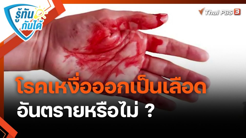 ​รู้ทันกันได้ : โรคเหงื่อออกเป็นเลือด อันตรายหรือไม่ ?