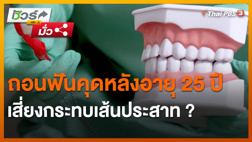 ชัวร์หรือมั่ว : ถอนฟันคุดหลังอายุ 25 ปี เสี่ยงกระทบเส้นประสาท ?