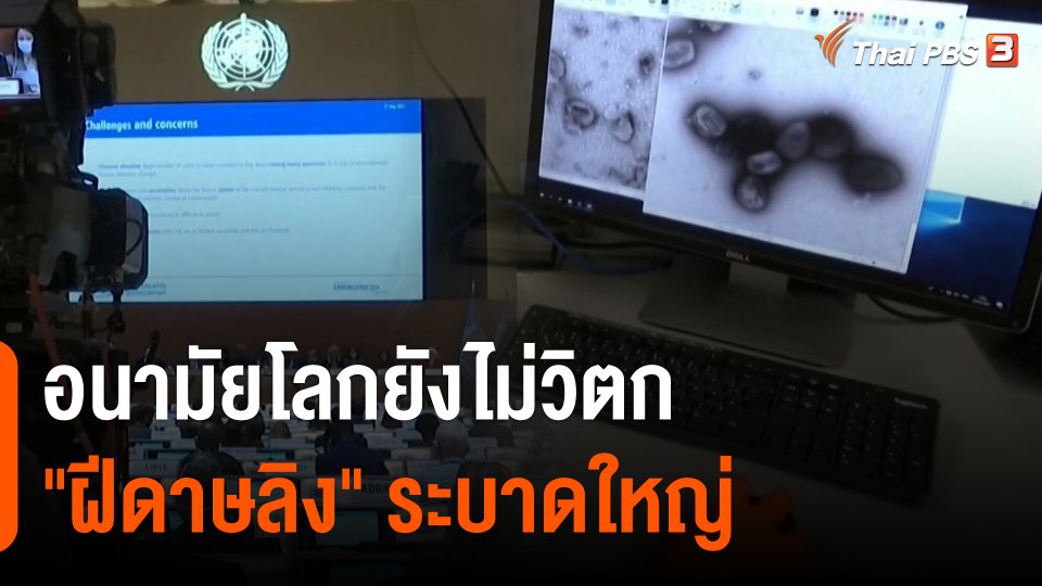 อนามัยโลกยังไม่วิตก "ฝีดาษลิง" ระบาดใหญ่