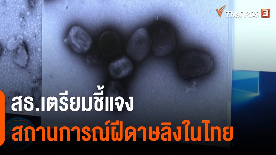 สธ.เตรียมชี้แจงสถานการณ์ฝีดาษลิงในไทย