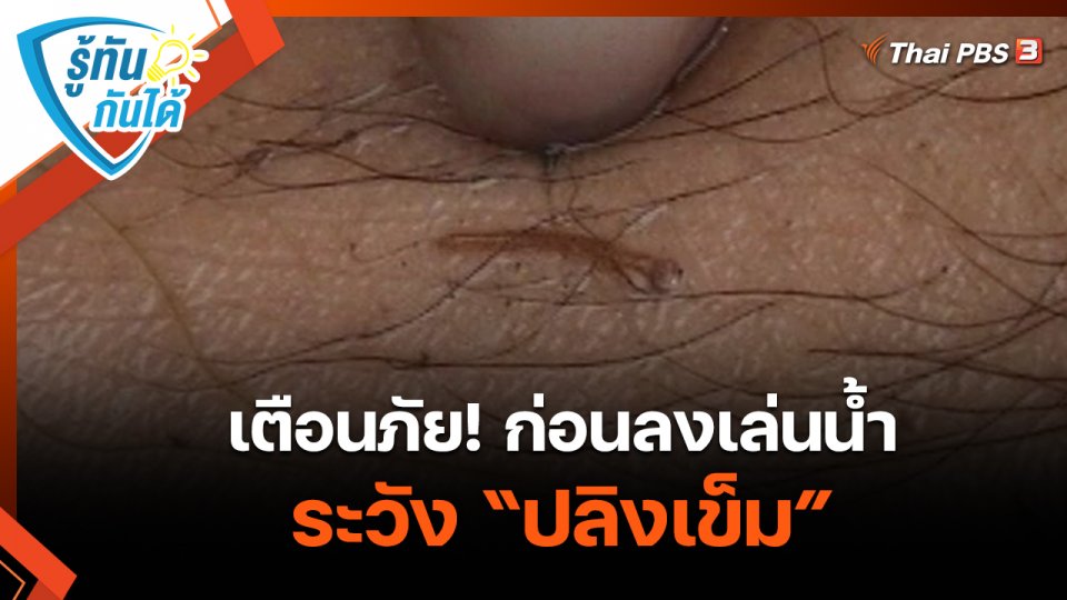 รู้ทันกันได้ : เตือนภัย! ก่อนลงเล่นน้ำระวัง “ปลิงเข็ม”