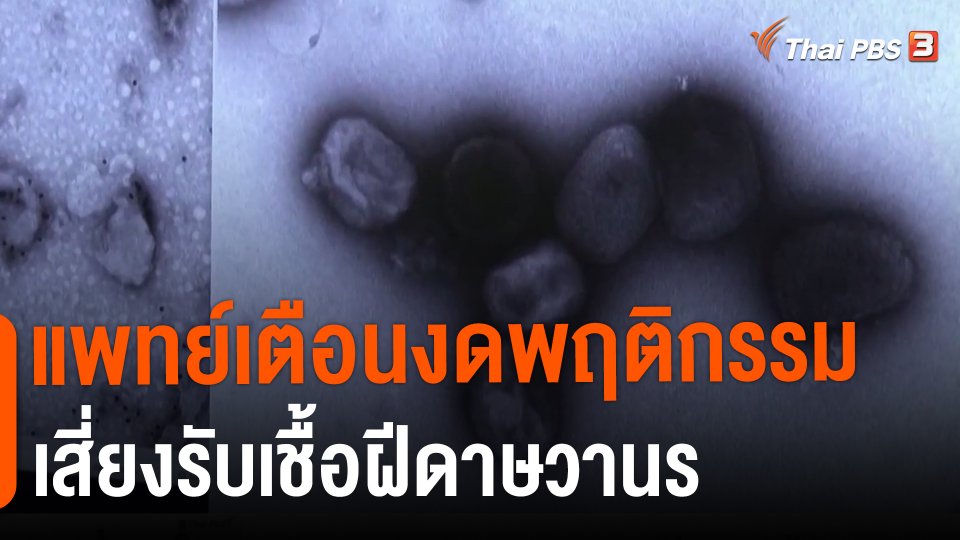 ​แพทย์เตือนงดพฤติกรรมเสี่ยงรับเชื้อฝีดาษวานร