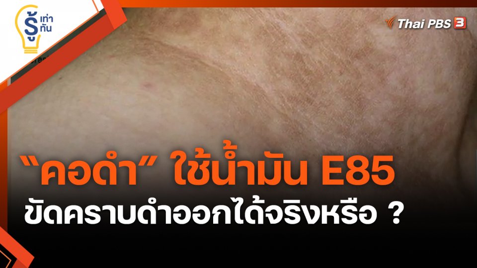 ​รู้เท่ารู้ทัน : “คอดำ” ใช้น้ำมัน E85 ขัดคราบดำออกได้จริงหรือ ?