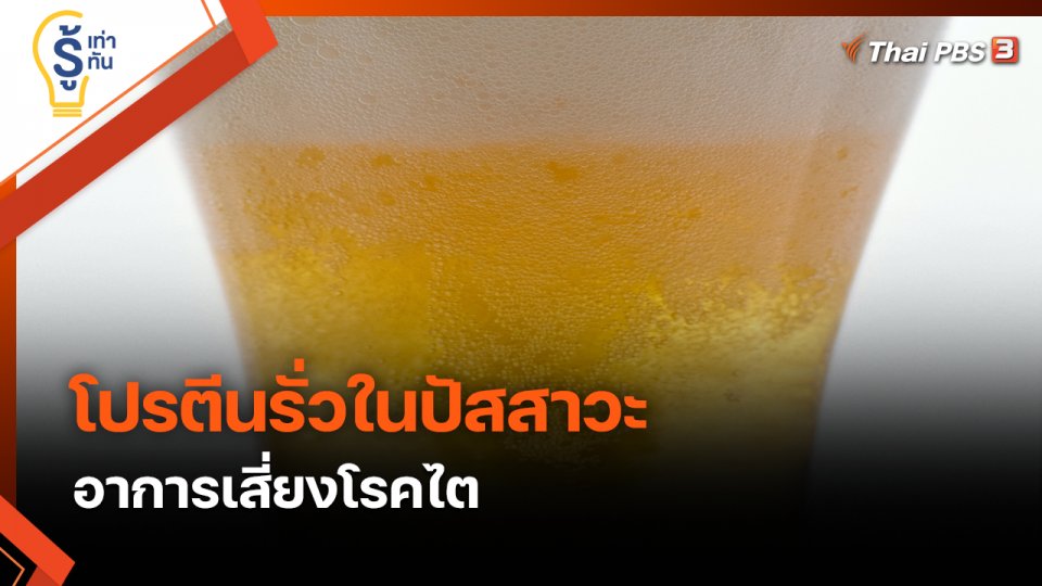 รู้เท่ารู้ทัน : "โปรตีนรั่วในปัสสาวะ" อาการเสี่ยงโรคไต