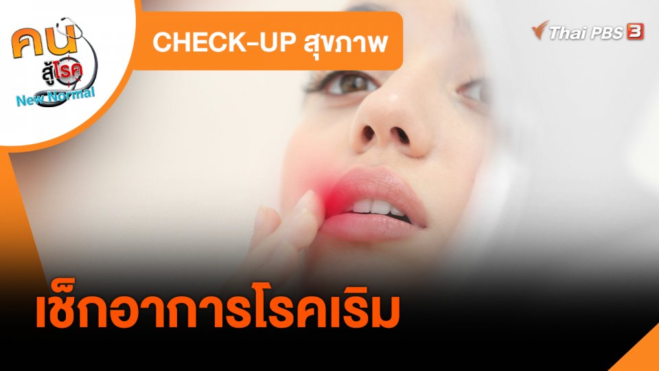 ​CHECK-UP สุขภาพ : เช็กอาการโรคเริม