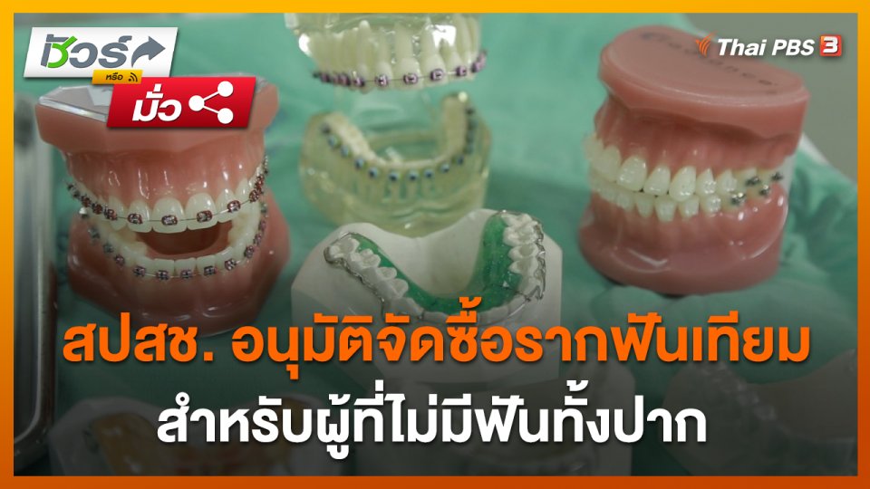 ชัวร์หรือมั่ว : สปสช. อนุมัติจัดซื้อรากฟันเทียม สำหรับผู้ที่ไม่มีฟันทั้งปาก ?
