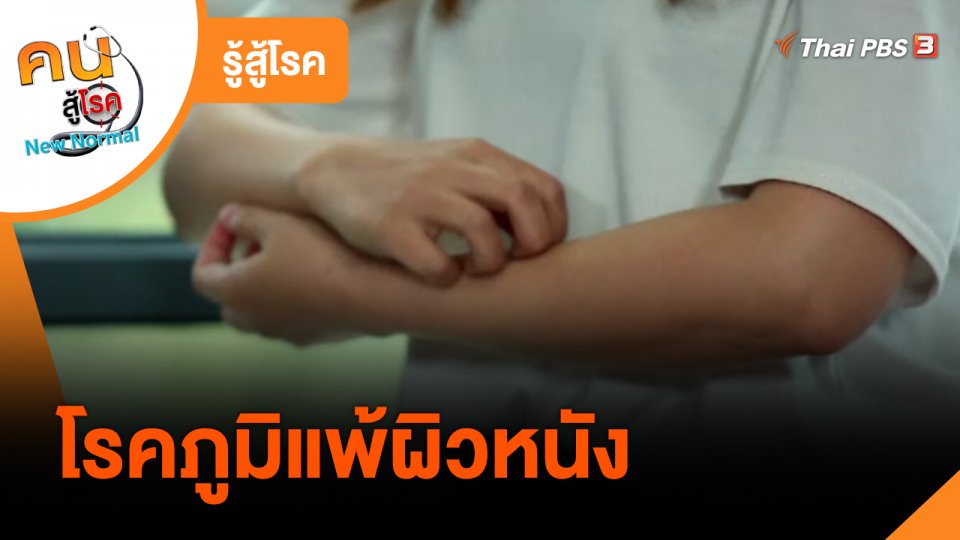 รู้สู้โรค : โรคภูมิแพ้ผิวหนัง
