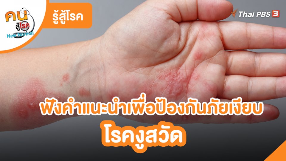 รู้สู้โรค : ฟังคำแนะนำเพื่อป้องกันภัยเงียบโรคงูสวัด