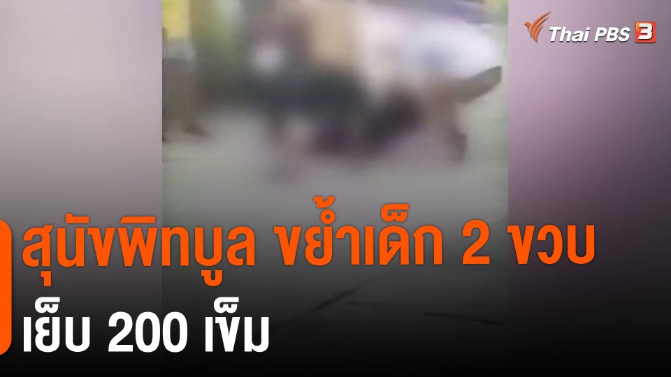 ​สุนัขพิทบูล ขย้ำเด็ก 2 ขวบเย็บ 200 เข็ม
