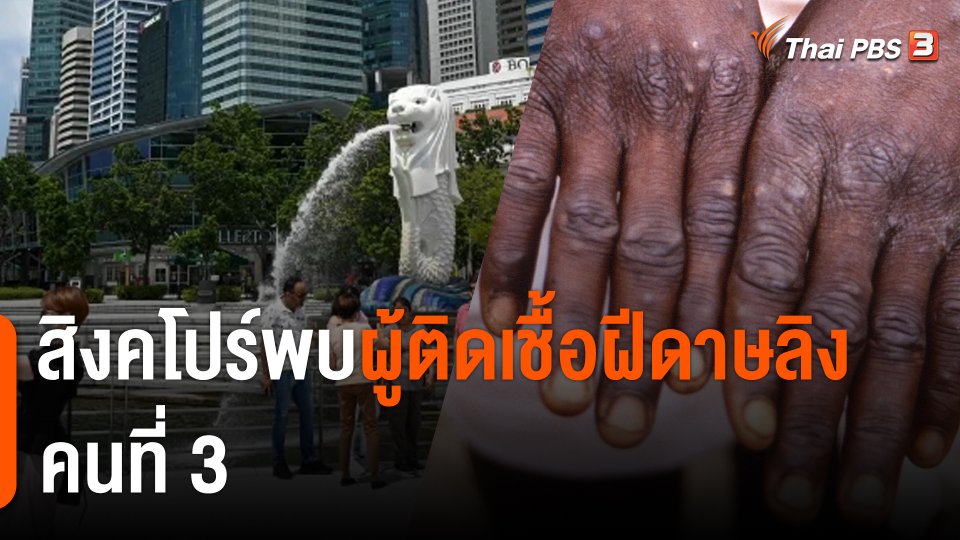 สิงคโปร์พบผู้ติดเชื้อฝีดาษลิงคนที่ 3
