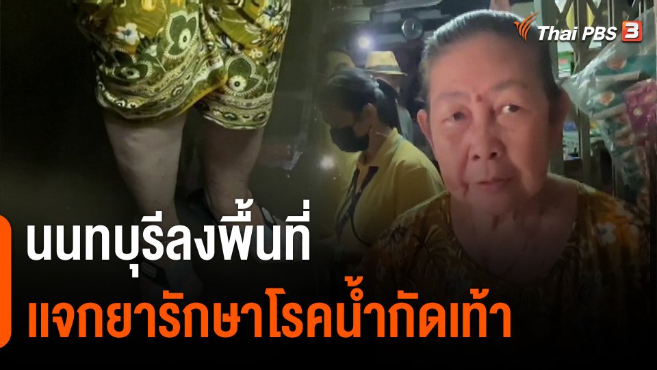 นนทบุรีลงพื้นที่เเจกยารักษาโรคน้ำกัดเท้า