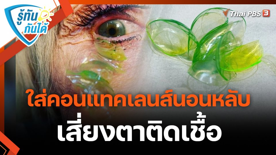​รู้ทันกันได้ : ใส่คอนแทคเลนส์นอนหลับ เสี่ยงตาติดเชื้อ