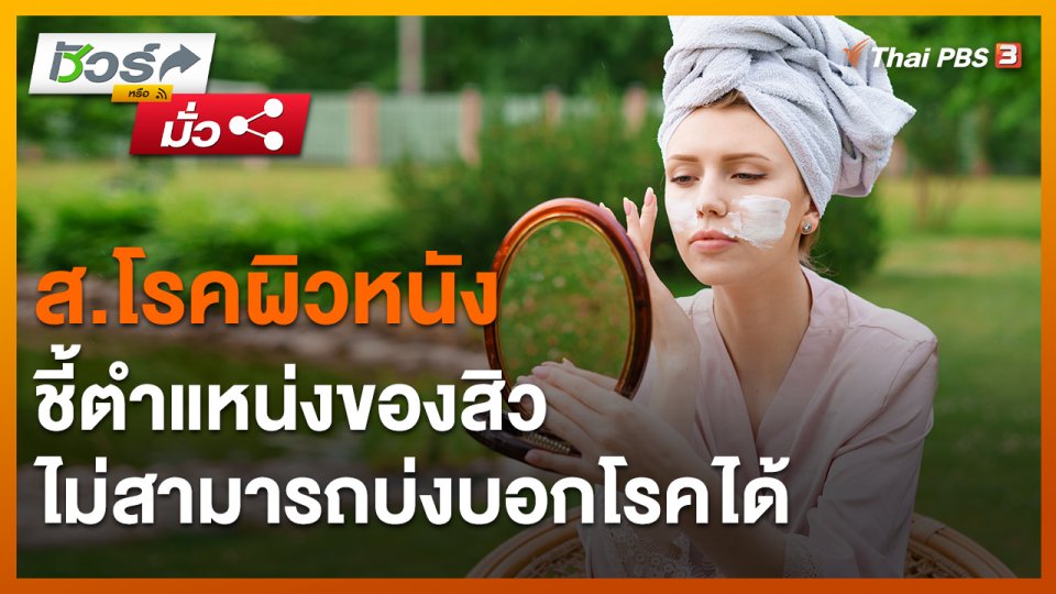 ชัวร์หรือมั่ว : ส.โรคผิวหนัง ชี้ตำแหน่งของสิวไม่สามารถบ่งบอกโรคได้