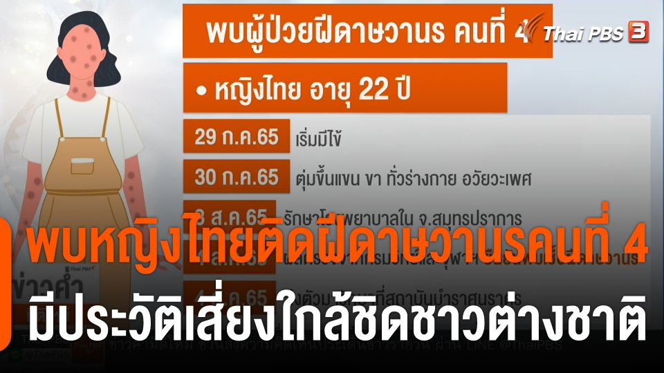 พบหญิงไทยติดฝีดาษวานรคนที่ 4 มีประวัติเสี่ยงใกล้ชิดชาวต่างชาติ
