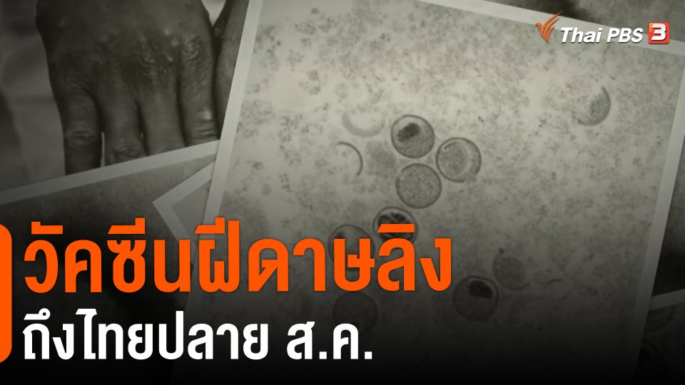 ​วัคซีนฝีดาษลิงถึงไทยปลาย ส.ค.