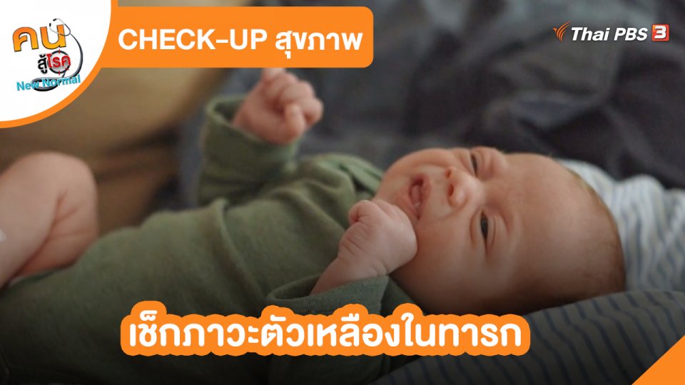 ​CHECK-UP สุขภาพ : เช็กภาวะตัวเหลืองในทารก