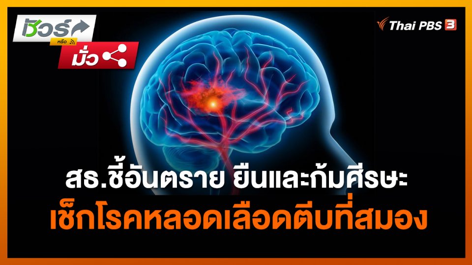 ชัวร์หรือมั่ว : สธ.ชี้อันตราย ยืนและก้มศีรษะเช็กโรคหลอดเลือดตีบที่สมอง