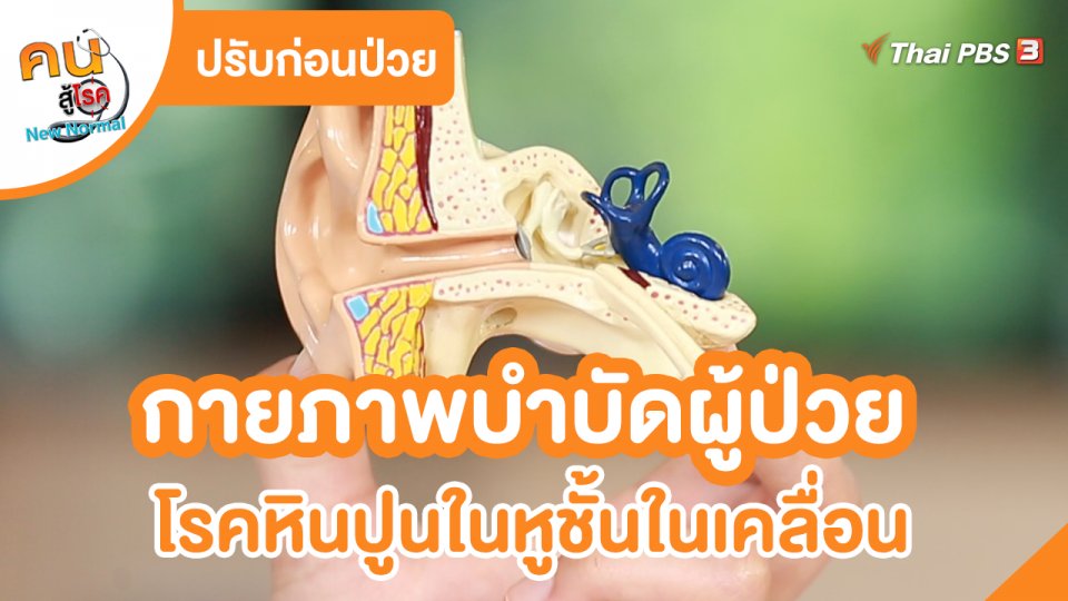 ปรับก่อนป่วย : กายภาพบำบัดผู้ป่วย โรคหินปูนในหูชั้นในเคลื่อน