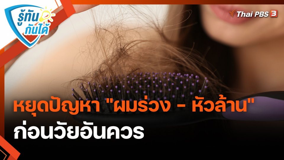 รู้ทันกันได้ : หยุดปัญหา "ผมร่วง - หัวล้าน" ก่อนวัยอันควร