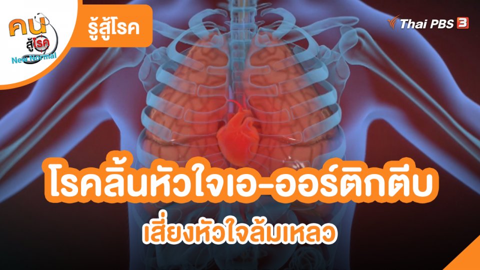 รู้สู้โรค : โรคลิ้นหัวใจเอ-ออร์ติกตีบ เสี่ยงหัวใจล้มเหลว