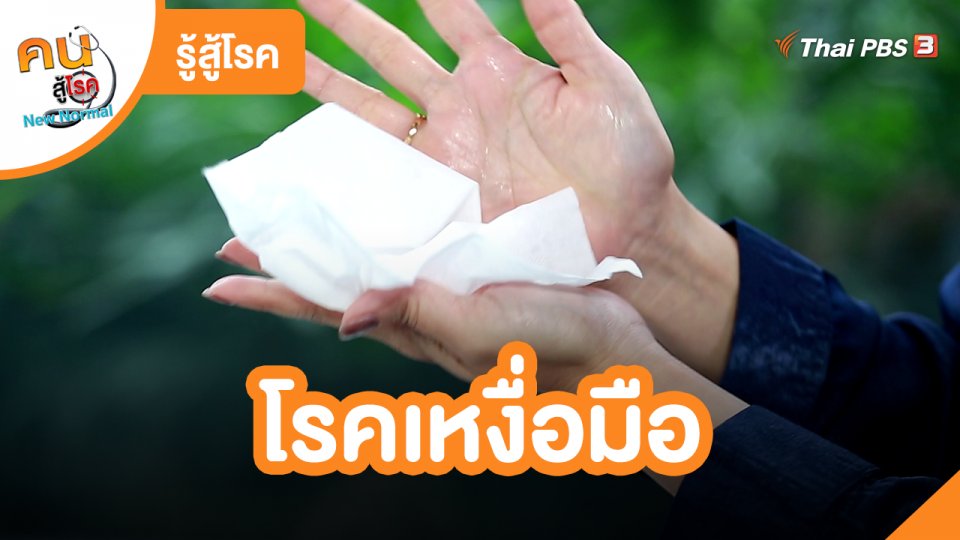 รู้สู้โรค : โรคเหงื่อมือ