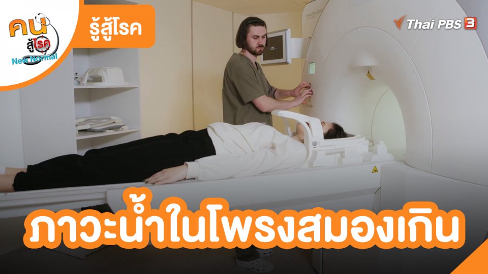 รู้สู้โรค : ภาวะน้ำในโพรงสมองเกิน