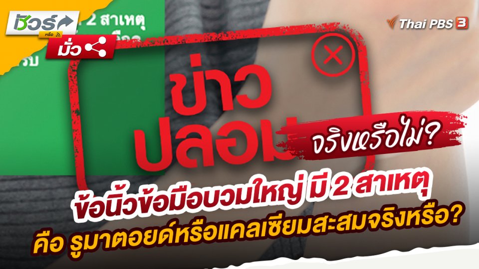 ​ชัวร์หรือมั่ว : ข้อนิ้วข้อมือบวมใหญ่ มี 2 สาเหตุ คือ รูมาตอยด์หรือแคลเซียมสะสมจริงหรือ?