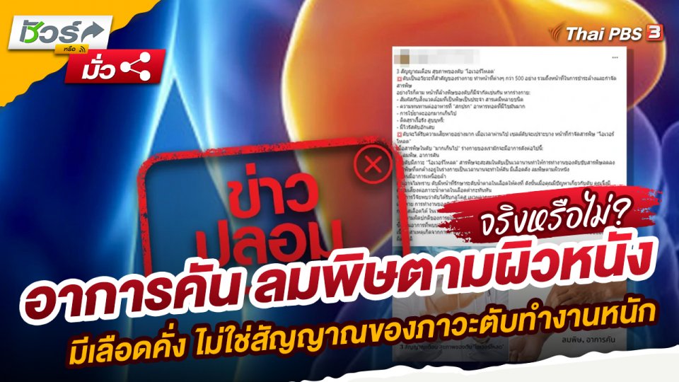 อาการคัน ลมพิษตามผิวหนัง มีเลือดคั่ง ไม่ใช่สัญญาณของภาวะตับทำงานหนัก