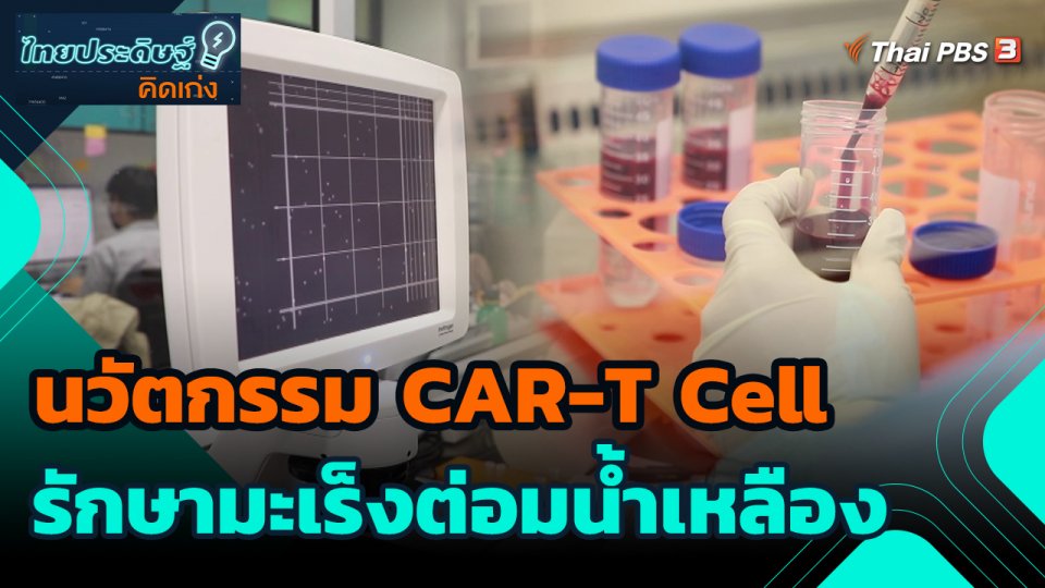 นวัตกรรม CAR-T Cell รักษามะเร็งต่อมน้ำเหลือง
