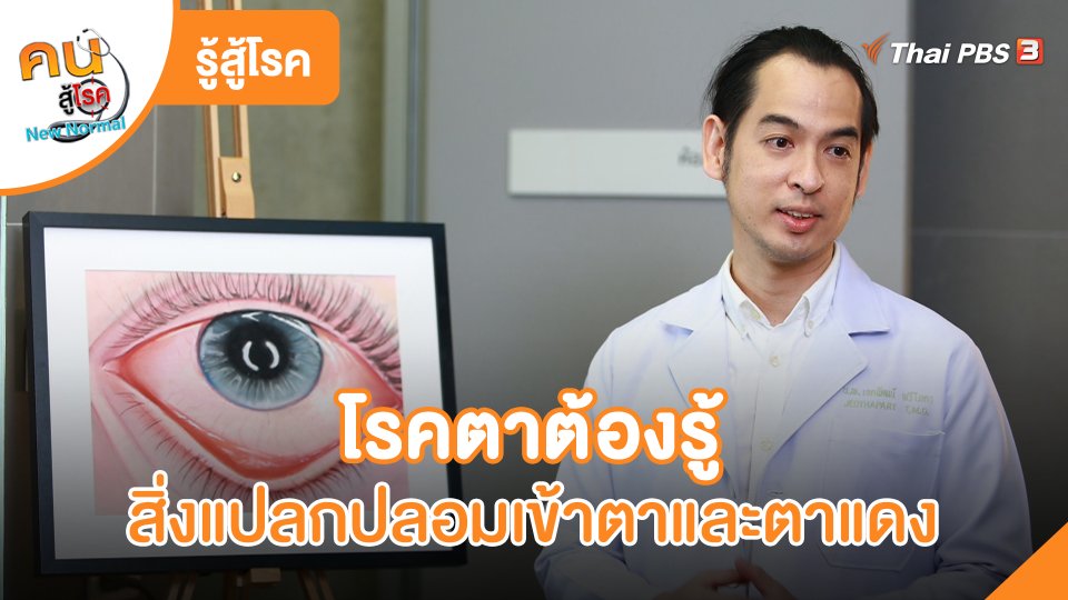 รู้สู้โรค : โรคตาต้องรู้ สิ่งแปลกปลอมเข้าตาและตาแดงจากเครื่องสำอาง