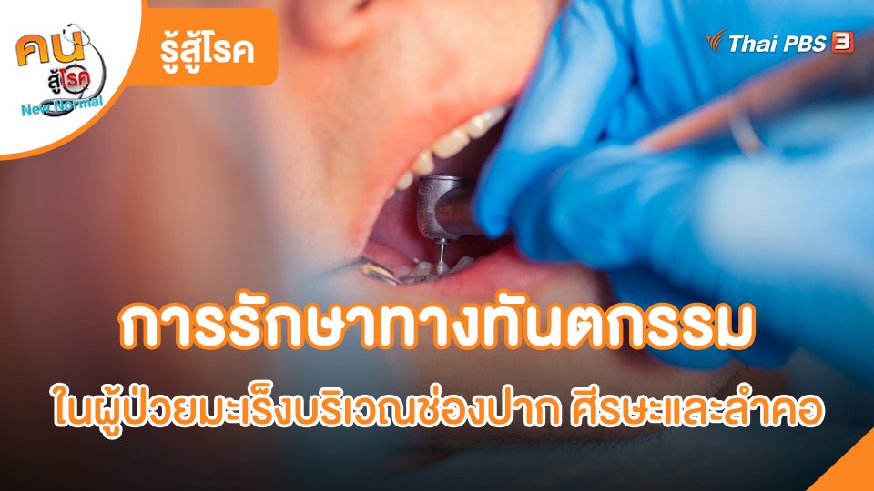 การรักษาทางทันตกรรมในผู้ป่วยมะเร็งบริเวณช่องปาก ศีรษะและลำคอ