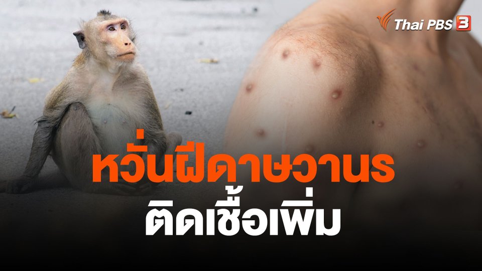 หวั่นฝีดาษวานรติดเชื้อเพิ่ม