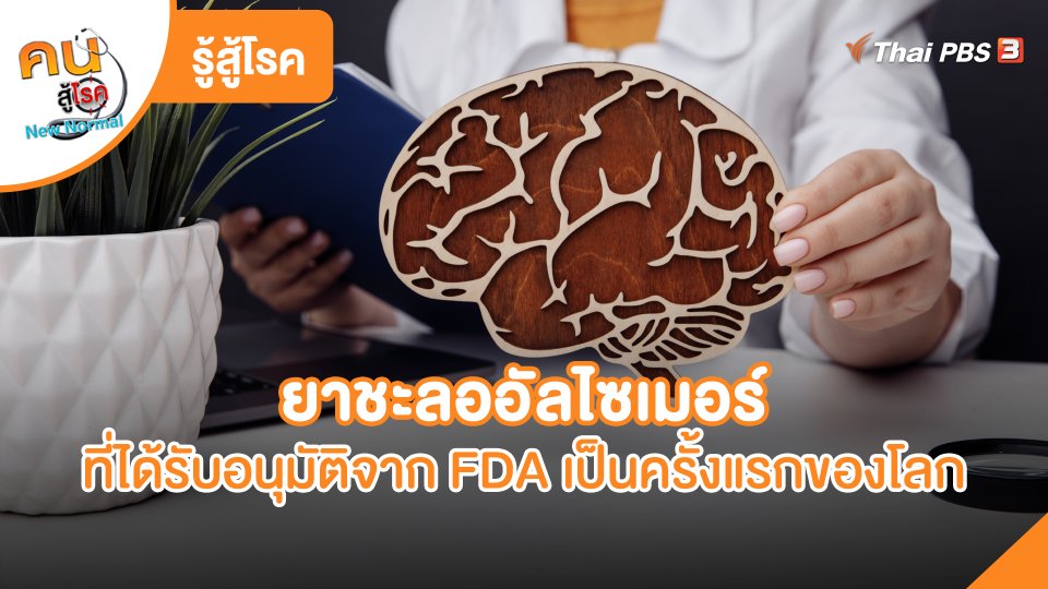 รู้สู้โรค : ยาชะลออัลไซเมอร์ที่ได้รับอนุมัติจาก FDA เป็นครั้งแรกของโลก