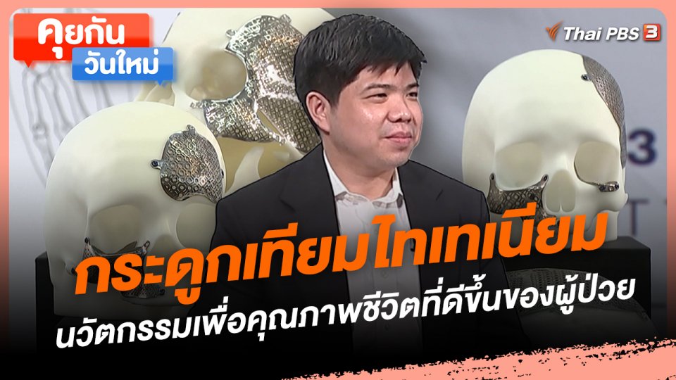 กระดูกเทียมไทเทเนียม นวัตกรรมเพื่อคุณภาพชีวิตที่ดีขึ้นของผู้ป่วย