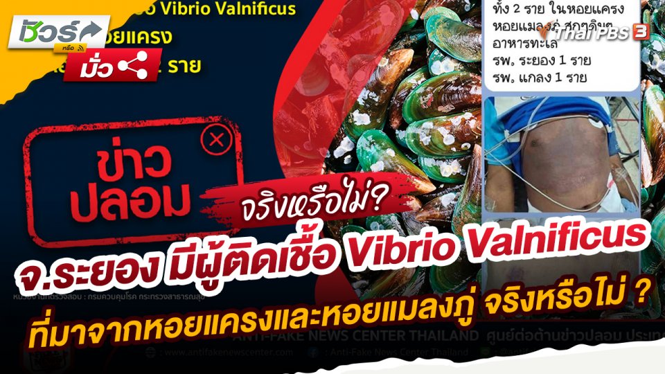 ชัวร์หรือมั่ว : จ.ระยอง มีผู้ติดเชื้อ Vibrio Valnificus ที่มาจากหอยแครงและหอยแมลงภู่ 2 ราย จริงหรือไม่ ?