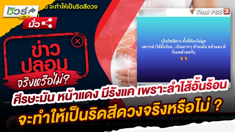 ​ชัวร์หรือมั่ว : ศีรษะมัน หน้าแดง มีรังแค เพราะลำไส้อั้นร้อน จะทำให้เป็นริดสีดวงทั้งที่ท้องไม่ผูกจริงหรือไม่?