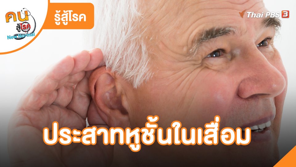 ประสาทหูชั้นในเสื่อม