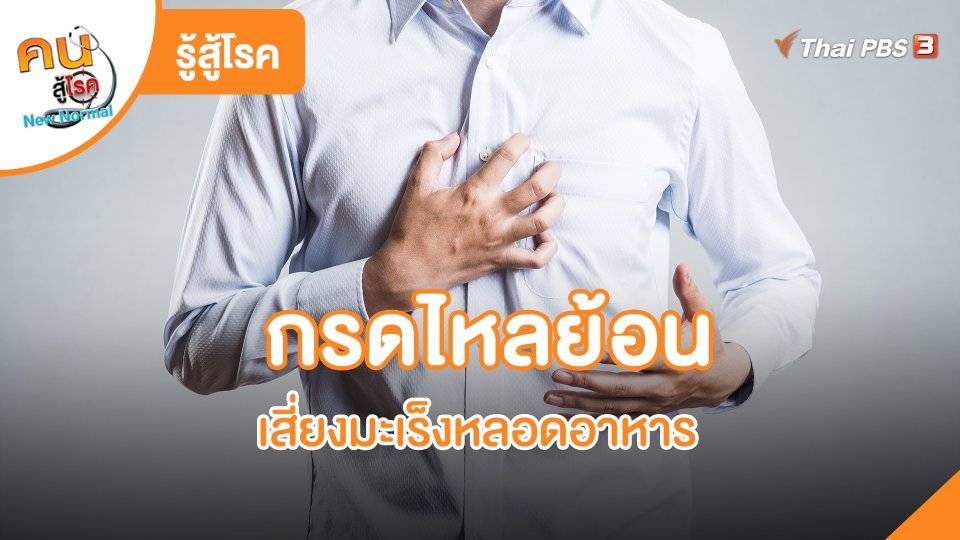 รู้สู้โรค : กรดไหลย้อนเสี่ยงมะเร็งหลอดอาหาร
