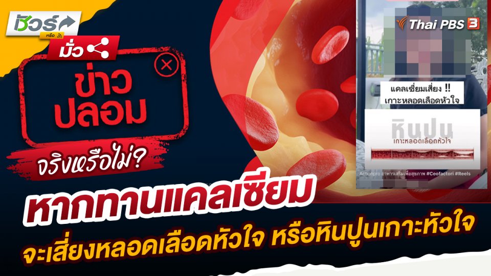 ชัวร์หรือมั่ว : หากทานแคลเซียมจะเสี่ยงหลอดเลือดหัวใจ หรือหินปูนเกาะหัวใจจริงหรือไม่?