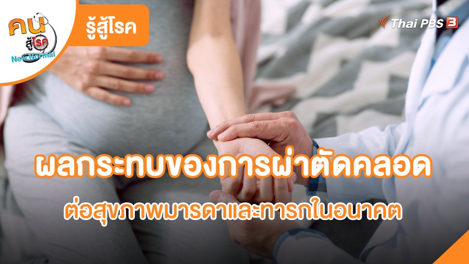 ผลกระทบของการผ่าตัดคลอดต่อสุขภาพมารดาและทารกในอนาคต