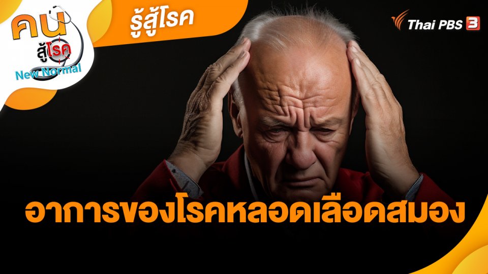 รู้สู้โรค : อาการของโรคหลอดเลือดสมอง